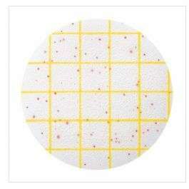 Image of Aerobic Count Plate
