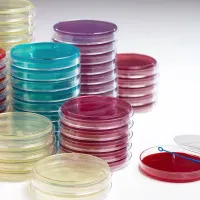 500g BLOOD AGAR BASE (INFUSION AGAR)